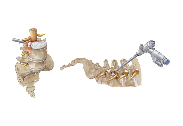 Cirurgia Minimamente Invasiva