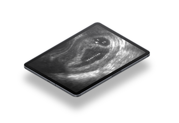 Ultrassom no Manejo da Dor